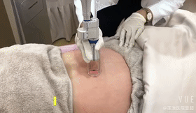 4.gif